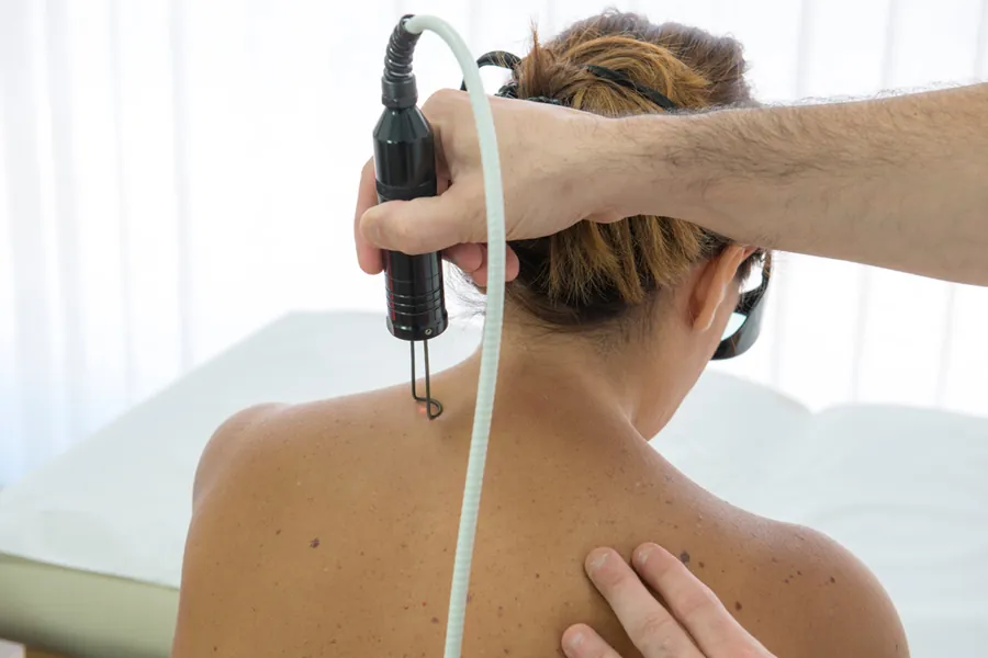 Trattamento con laser YAG (Hilterapia) su un paziente